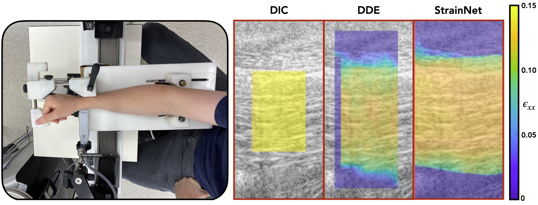 fe-lumbar-herniation